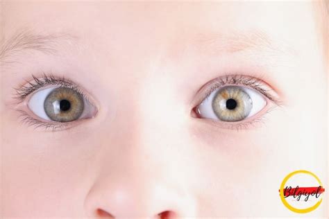 bebeklerde gözün yukarı kayması